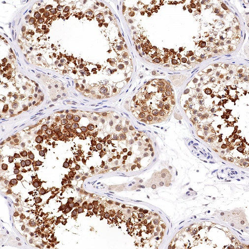 RUVBL1 Recombinant Rabbit mAb (S-1600-38)