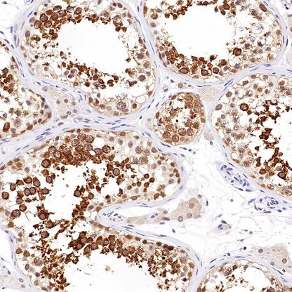 RUVBL1 Recombinant Rabbit mAb (S-1600-38)