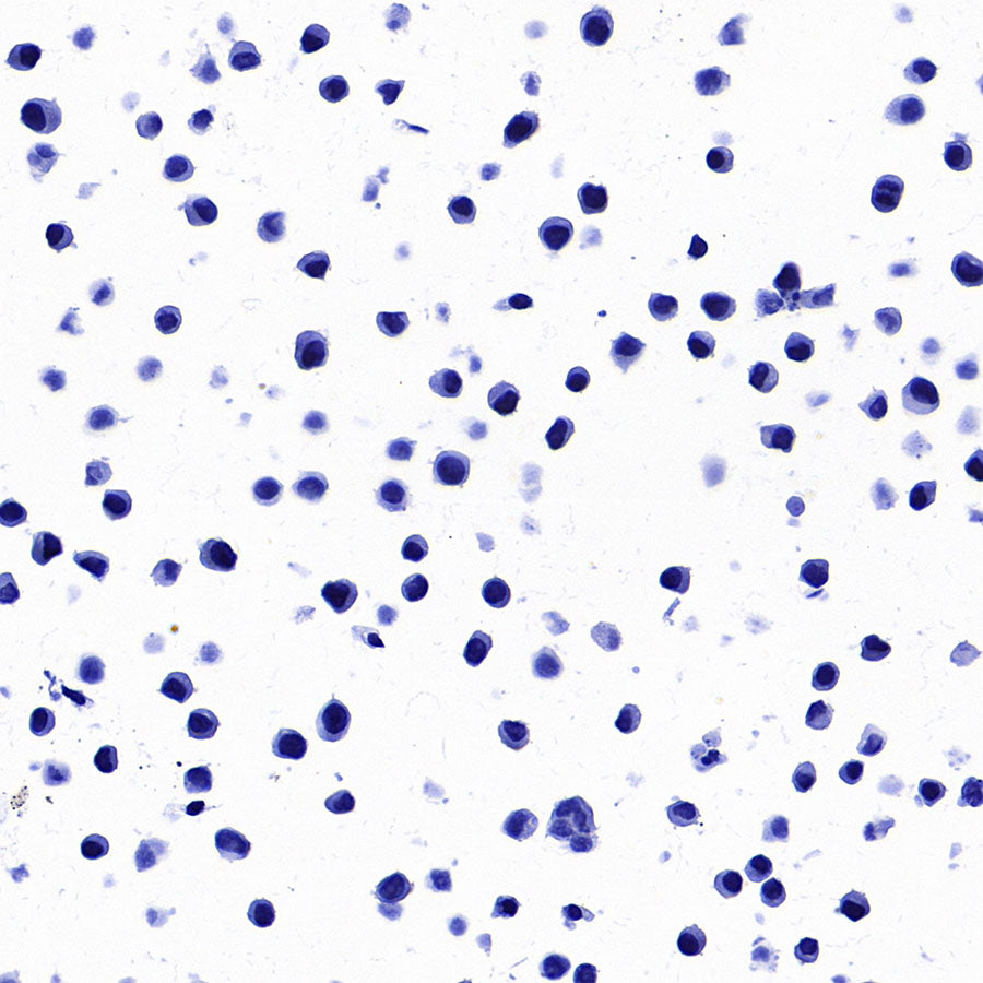 STEAP1 Recombinant Rabbit mAb (S-3613-107)