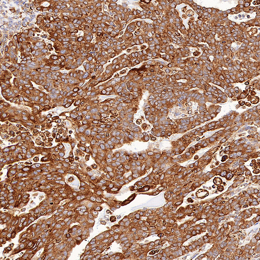 P4HB Recombinant Rabbit mAb