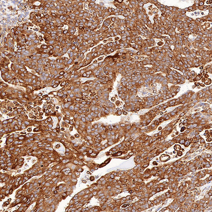 P4HB Recombinant Rabbit mAb