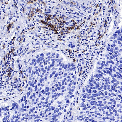 CD37 Recombinant Rabbit mAb (S-1662-61)