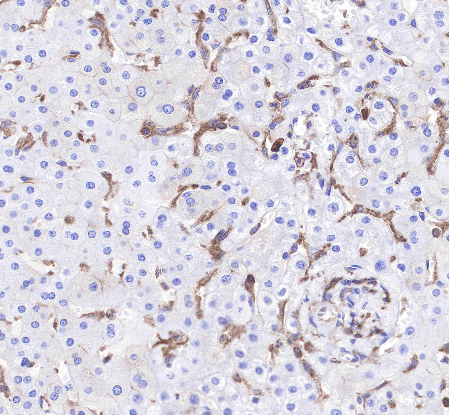 CD206 Recombinant Rabbit mAb(SDT-022-2)