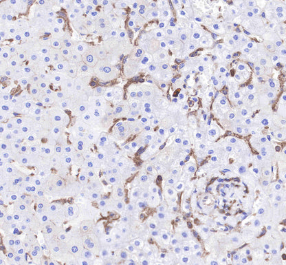CD206 Recombinant Rabbit mAb(SDT-022-2)