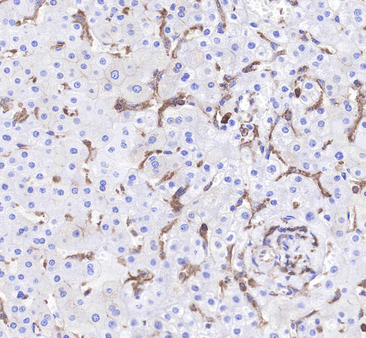 CD206 Recombinant Rabbit mAb(SDT-022-2)