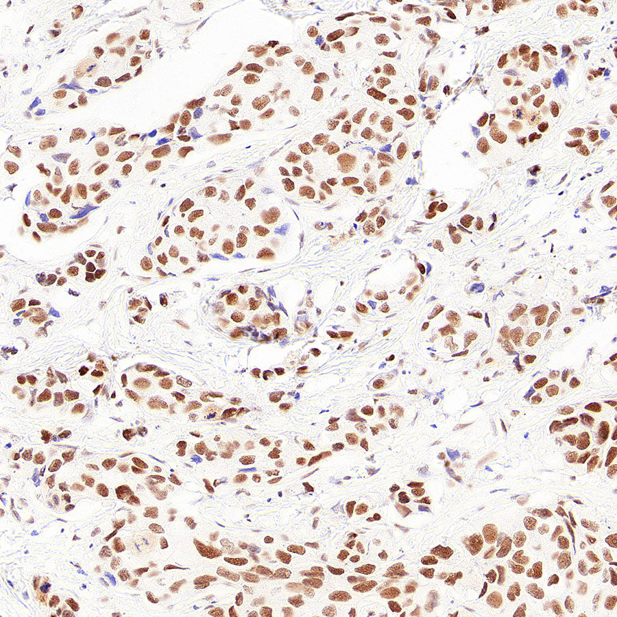 RAD21 Recombinant Rabbit mAb (S-4271-136)