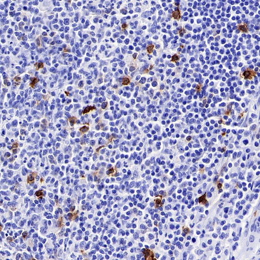 OX-40 Recombinant Rabbit mAb (S-R366)