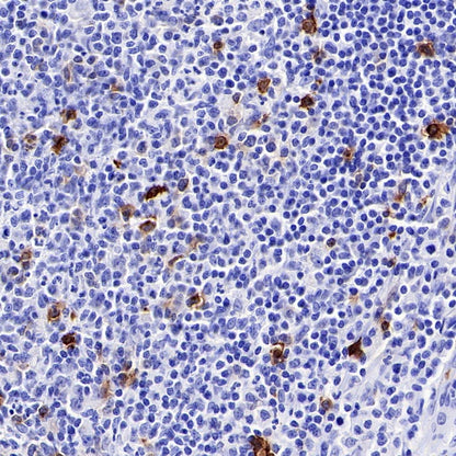 OX-40 Recombinant Rabbit mAb (S-R366)