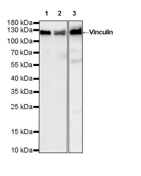 Vinculin Recombinant Rabbit mAb (S-5405)