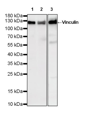 Vinculin Recombinant Rabbit mAb (S-5405)