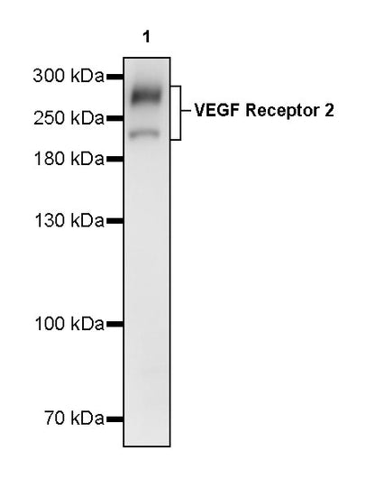 VEGF Receptor 2 Recombinant Rabbit mAb (S-3912-20)