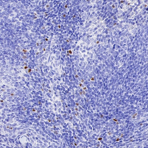 TBR2/Eomes Recombinant Rabbit mAb (SDT-1101-231)
