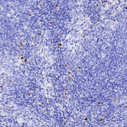 TBR2/Eomes Recombinant Rabbit mAb (SDT-1101-231)