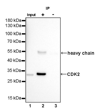 CDK2 Recombinant Rabbit mAb (SDT-064-40)