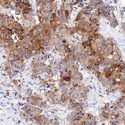 Ezrin Recombinant Rabbit mAb (S-R358)