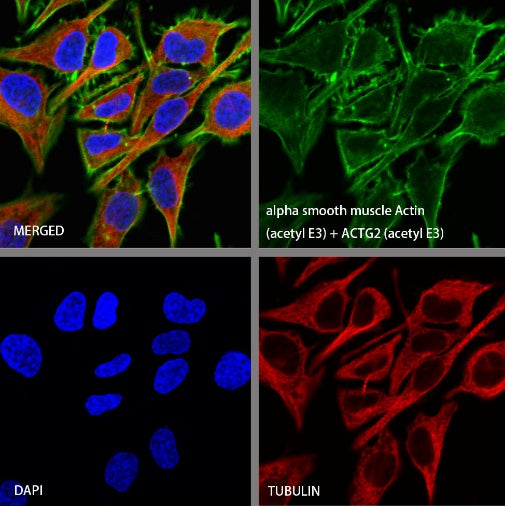 alpha smooth muscle Actin (acetyl E3) + ACTG2 (acetyl E3) Recombiant Rabbit mAb (S-3355)