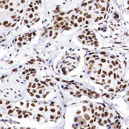 Rad21 Recombinant Rabbit mAb (S-M0006)