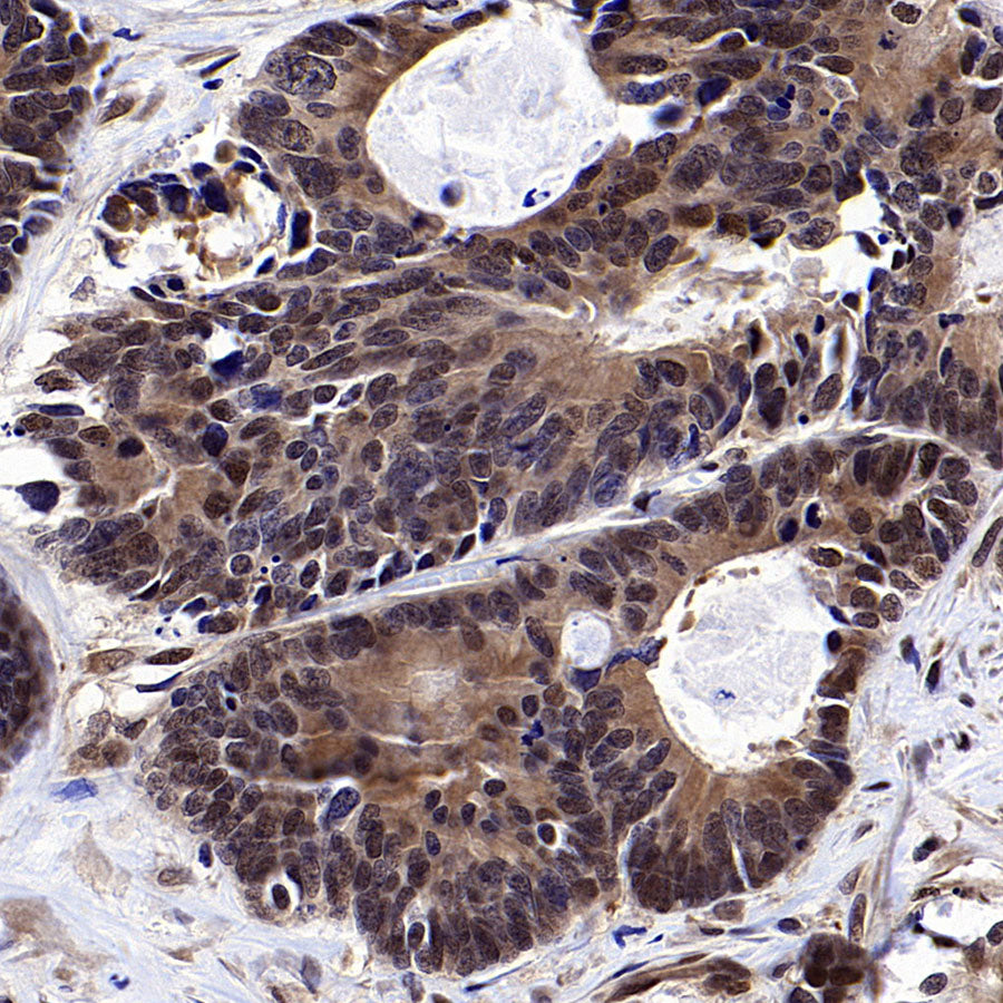 DCAF8 Recombinant Rabbit mAb (S-3483-11)