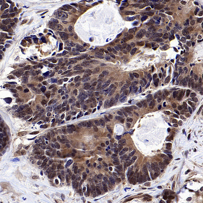 DCAF8 Recombinant Rabbit mAb (S-3483-11)