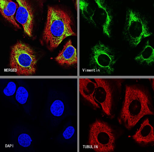 Vimentin Recombinant Rabbit mAb (SDT-029-120)