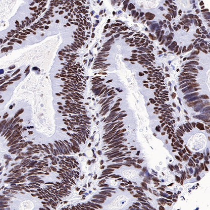 Histone H3 (acetyl K27) Rabbit pAb