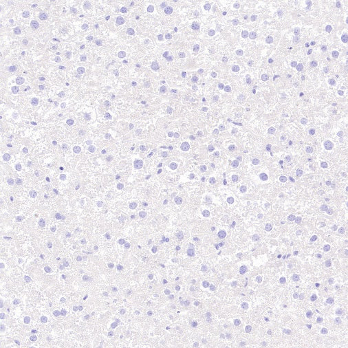 GDF3 Recombinant Rabbit mAb (S-3049-3)