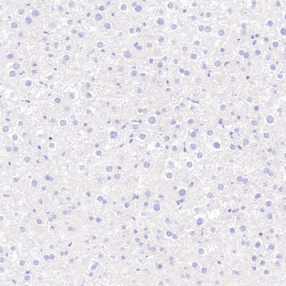 GDF3 Recombinant Rabbit mAb (S-3049-3)