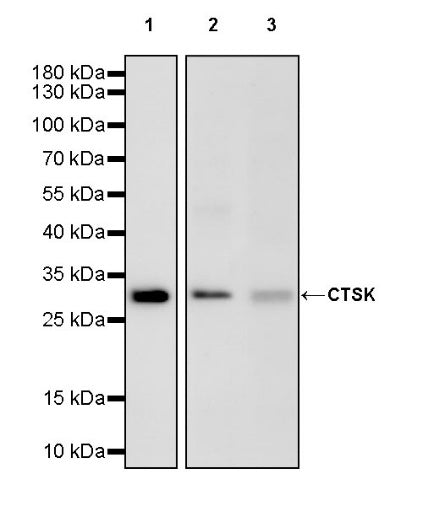 CTSK Recombinant Rabbit mAb (S-1370-278)