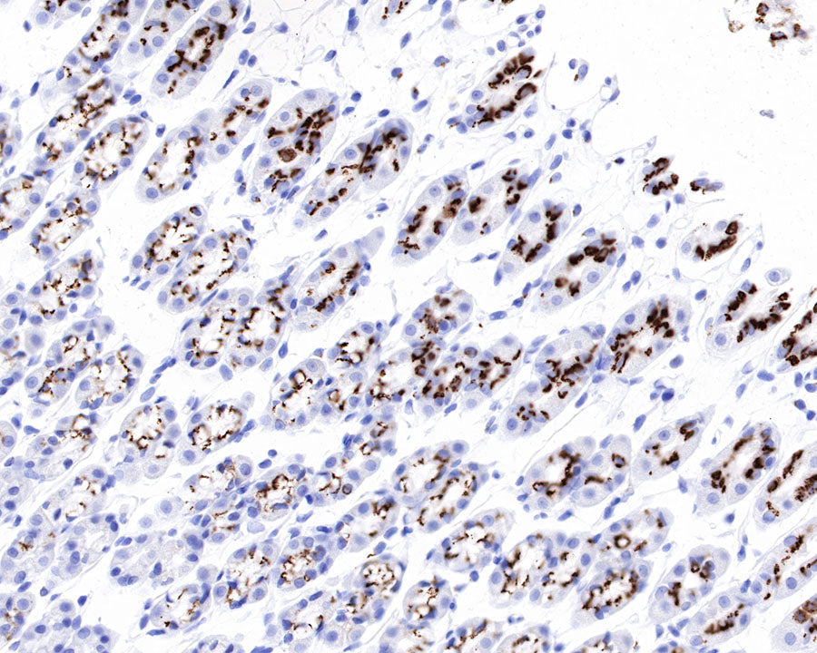 GP73/GOLPH2 Recombinant Rabbit mAb (SDT-231-102)