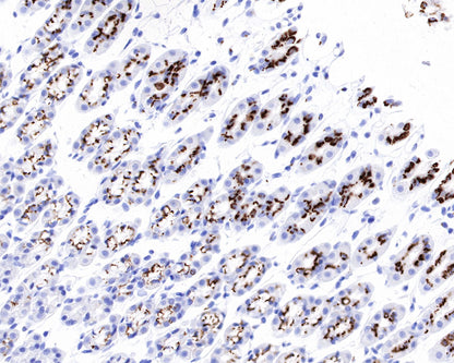 GP73/GOLPH2 Recombinant Rabbit mAb (SDT-231-102)