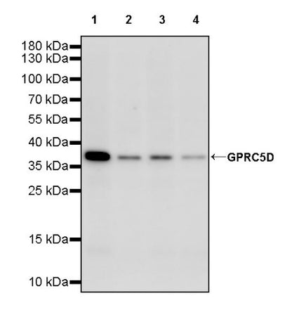 GPRC5D Recombinant Rabbit mAb (S-2169-203)