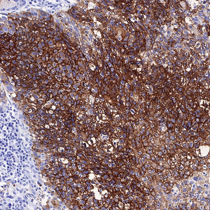 MUC4 Recombinant Rabbit mAb (SDT-841-13)