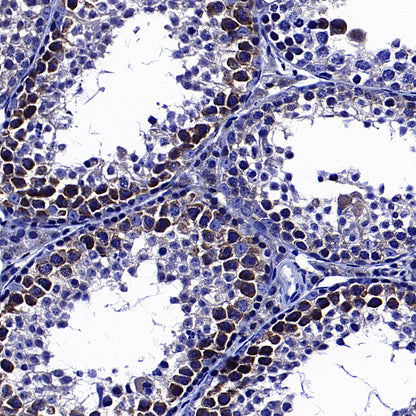 GFPT1 Recombinant Rabbit mAb (S-4752-19)