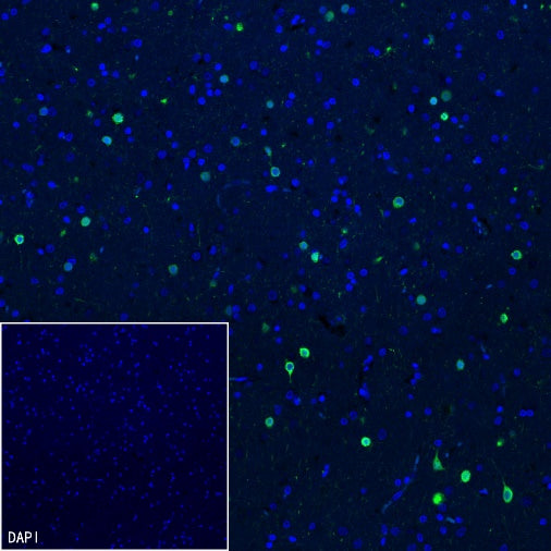 Calretinin Recombinant Rabbit mAb (SDT-2773-21)