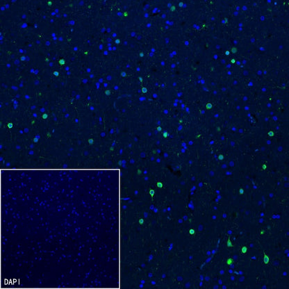 Calretinin Recombinant Rabbit mAb (SDT-2773-21)