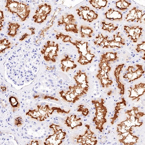 MDR1/ABCB1 Recombinant Rabbit mAb,PBS Only (SDT-872-21)