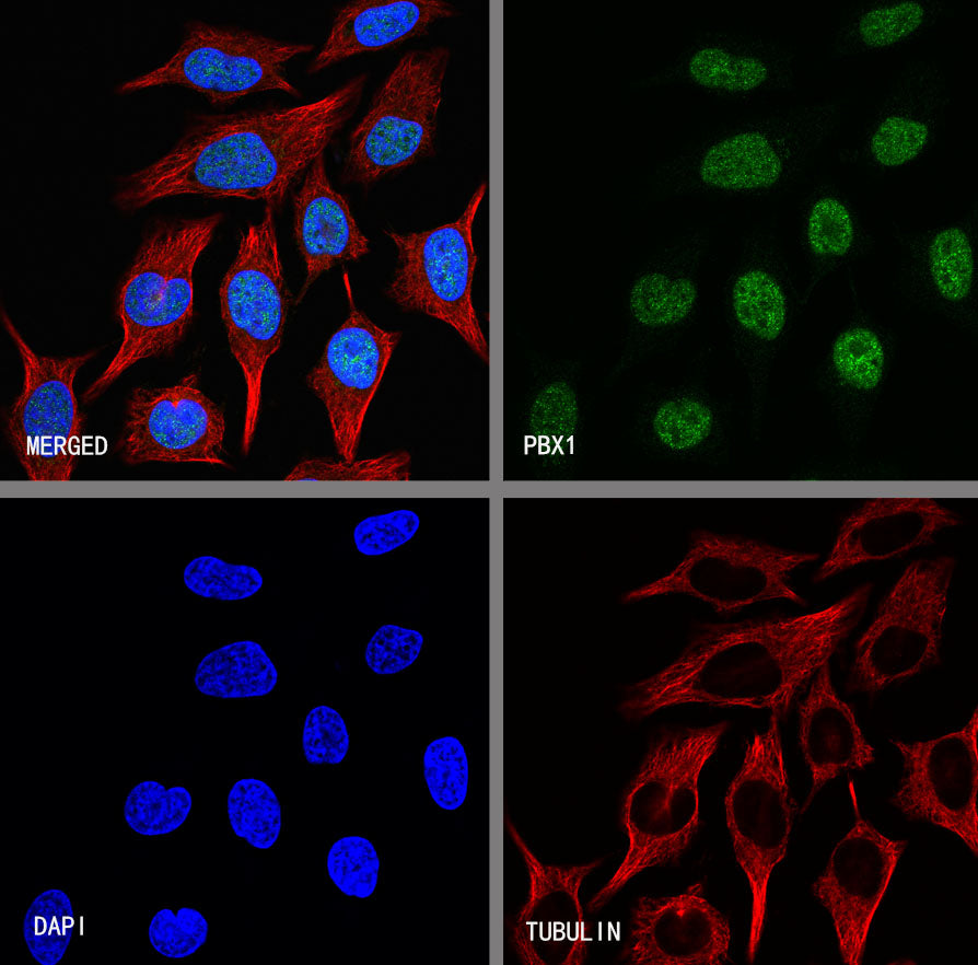 PBX1 Recombinant Rabbit mAb (S-4698-8)