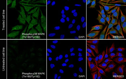 Phospho-p38 MAPK (Thr180/Tyr182) Recombinant Rabbit mAb (S-3861)
