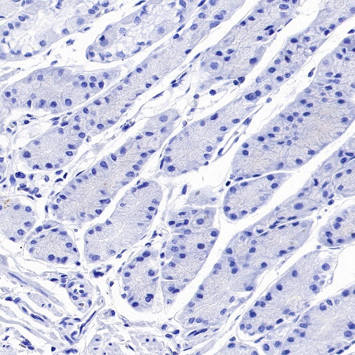 Parvalbumin Recombinant Rabbit mAb (S-1620-10)