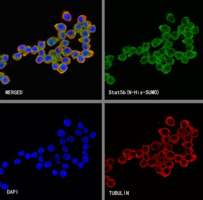 Stat5b Recombinant Rabbit mAb (S-2951-34)
