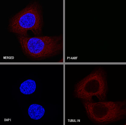 p14ARF Recombinant Rabbit mAb (S-R244)