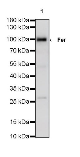 Fer Recombinant Rabbit mAb (S-R303)