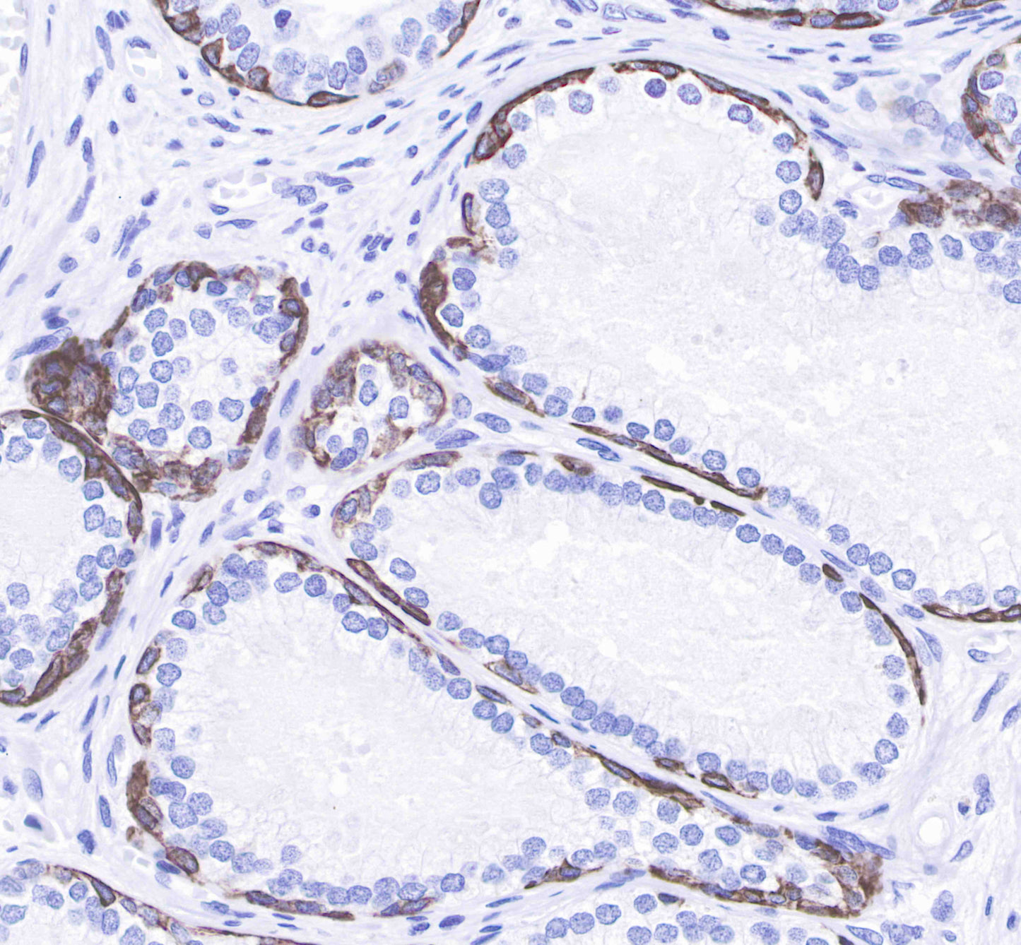 Keratin 14 Recombinant Rabbit mAb(SDT-023-1)