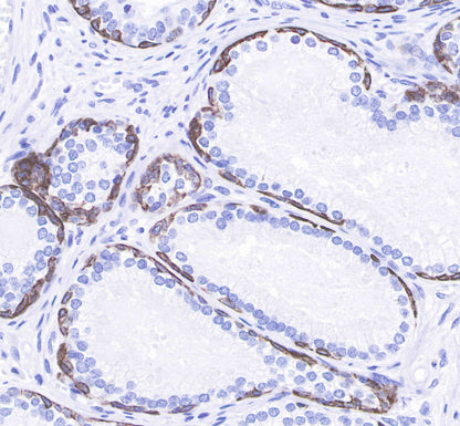 Keratin 14 Recombinant Rabbit mAb(SDT-023-1)