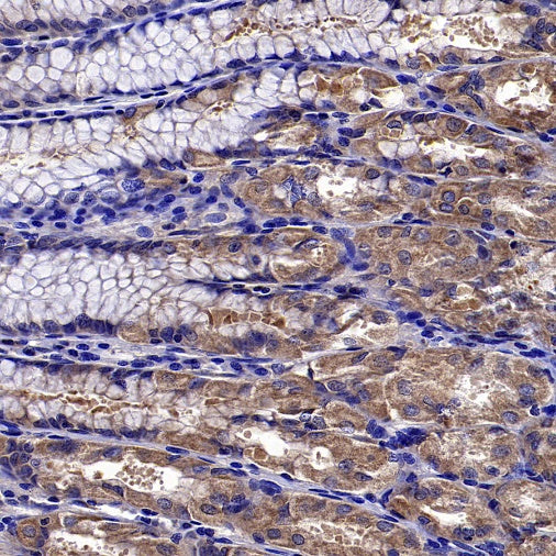 ADRB2 Recombinant Rabbit mAb (S-2418-144)