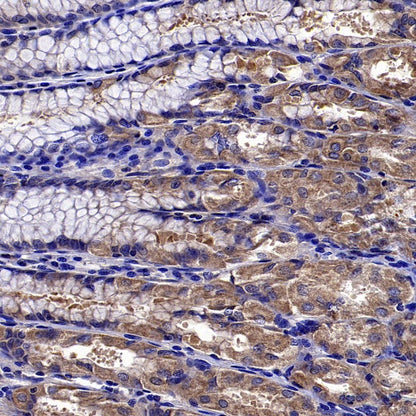 ADRB2 Recombinant Rabbit mAb (S-2418-144)