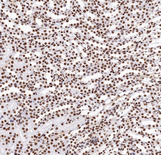 TDP-43 Recombinant Rabbit mAb (S-989-41)
