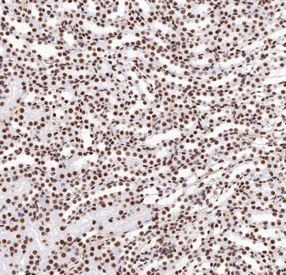TDP-43 Recombinant Rabbit mAb (S-989-41)