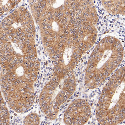 PDIA3 Rabbit Polyclonal Antibody