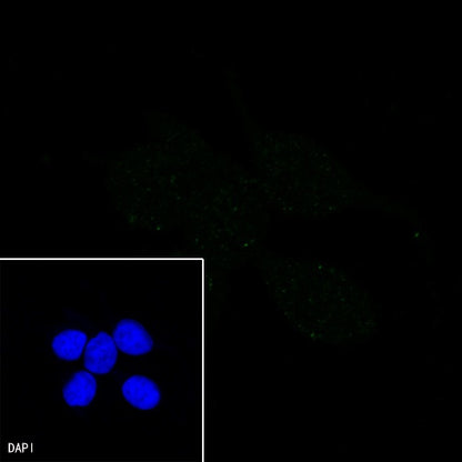CHI3L1 Recombinant Rabbit mAb (S-324-38)